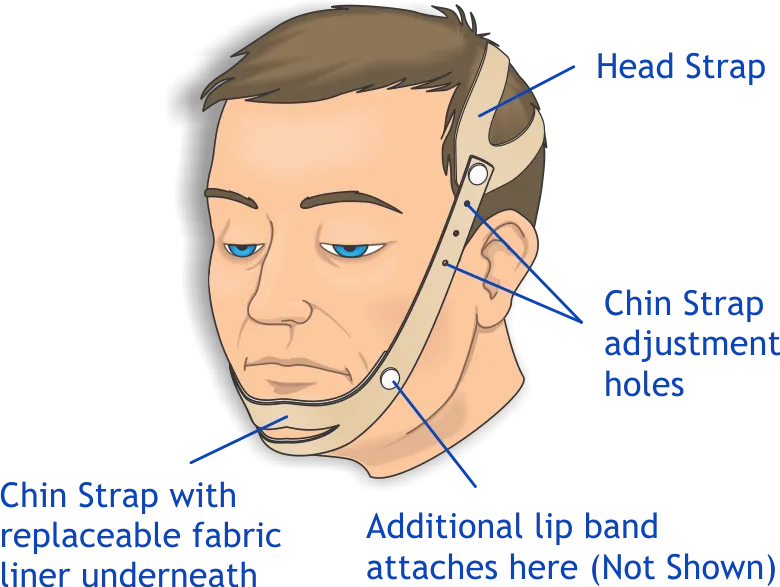 Urocare 6200 Anti-Snoring Strap. Includes: 1 Head Strap (#620001), 1 Chin Strap (#620002), 1 Lip Strap (#620004), 2 Chin Strap Liners (#620003), 4 Plastic Buttons (#603402), Illustrated Use And Care Instructions (#Pi6200)